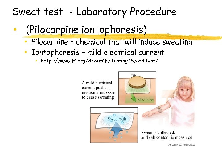 Sweat test - Laboratory Procedure • (Pilocarpine iontophoresis) • Pilocarpine – chemical that will