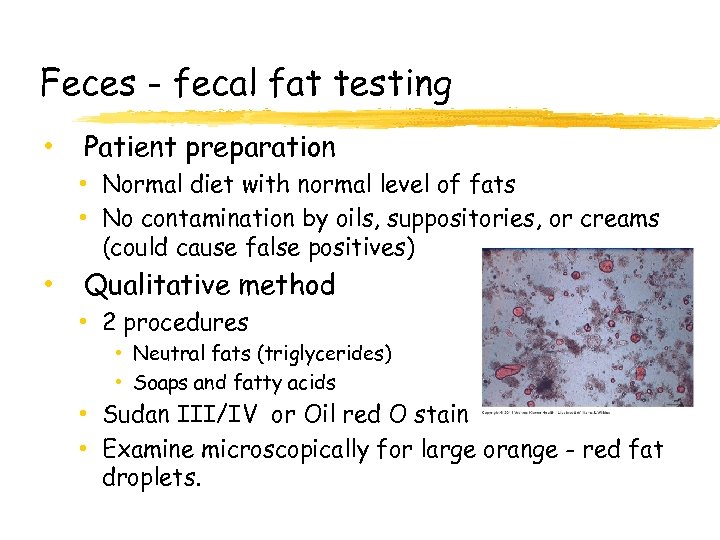 Feces - fecal fat testing • Patient preparation • Normal diet with normal level