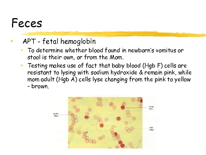 Feces • APT - fetal hemoglobin • To determine whether blood found in newborn’s