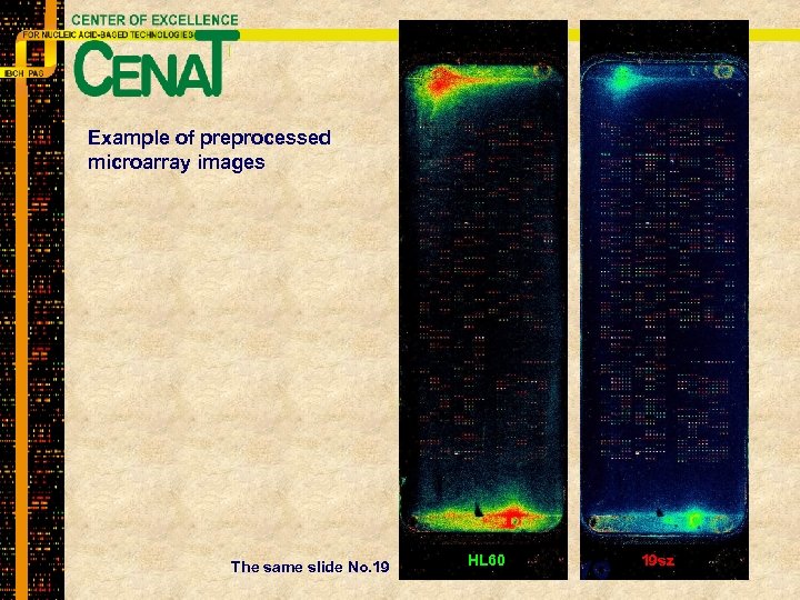 Example of preprocessed microarray images The same slide No. 19 HL 60 19 sz