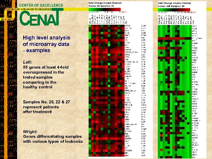 High level analysis of microarray data - examples Left: 55 genes at least 4