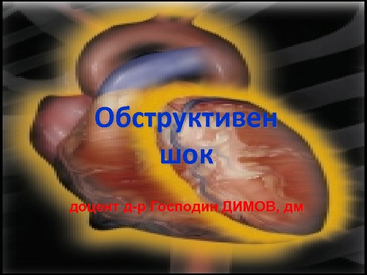 Обструктивен шок доцент д-р Господин ДИМОВ, дм 