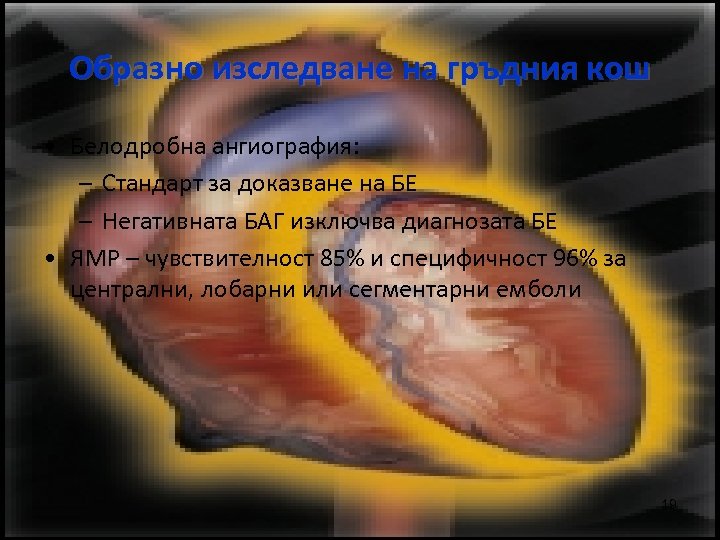 Образно изследване на гръдния кош • Белодробна ангиография: – Стандарт за доказване на БЕ