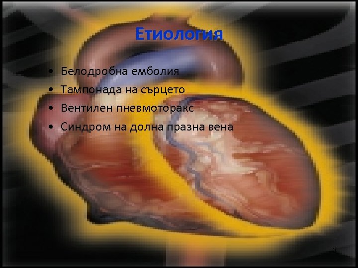 Етиология • • Белодробна емболия Тампонада на сърцето Вентилен пневмоторакс Синдром на долна празна