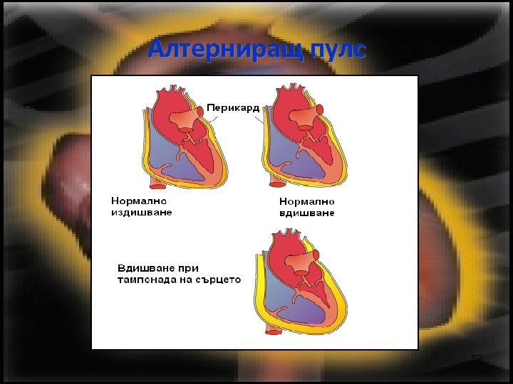 Алтерниращ пулс 52 