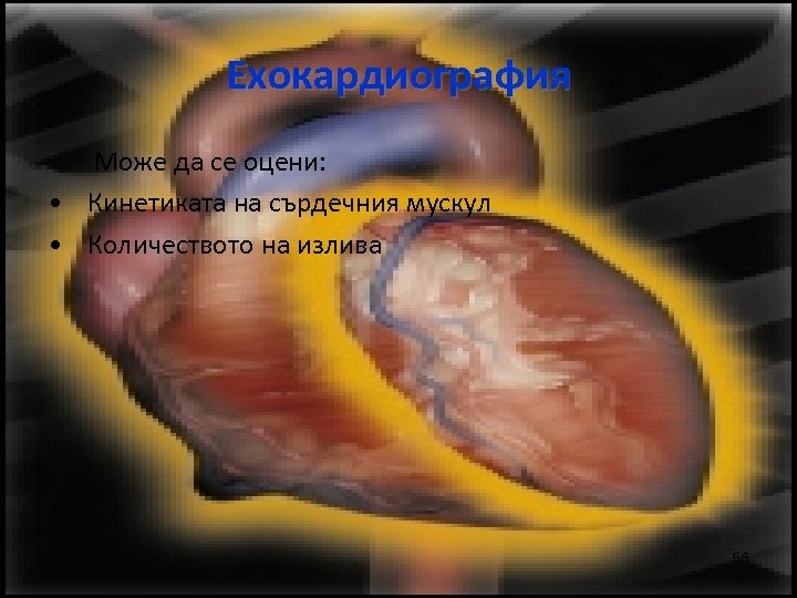 Ехокардиография Може да се оцени: • Кинетиката на сърдечния мускул • Количеството на излива
