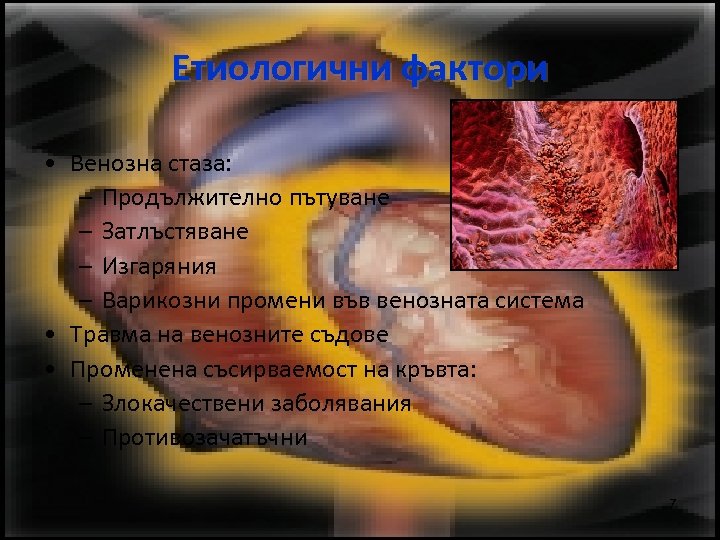 Етиологични фактори • Венозна стаза: – Продължително пътуване – Затлъстяване – Изгаряния – Варикозни