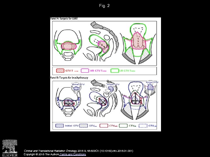 Fig. 2 Clinical and Translational Radiation Oncology 2018 9, 48 -60 DOI: (10. 1016/j.