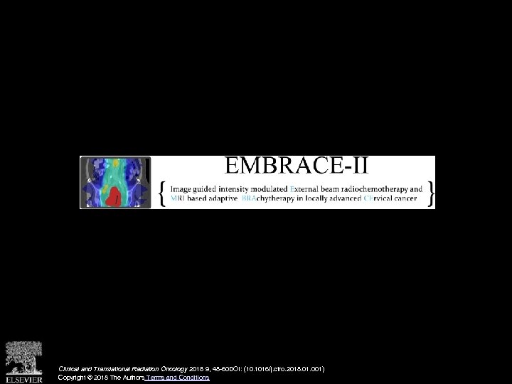 Clinical and Translational Radiation Oncology 2018 9, 48 -60 DOI: (10. 1016/j. ctro. 2018.