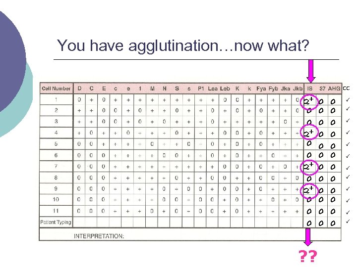 You have agglutination…now what? CC 2+ 0 0 0 ? ? 0 0 0