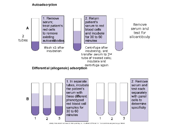 Remove serum and test for alloantibody 2 tubes Wash x 3 after incubation Centrifuge