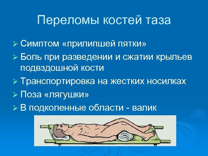 Переломы костей таза Ø Симптом «прилипшей пятки» Ø Боль при разведении и сжатии крыльев