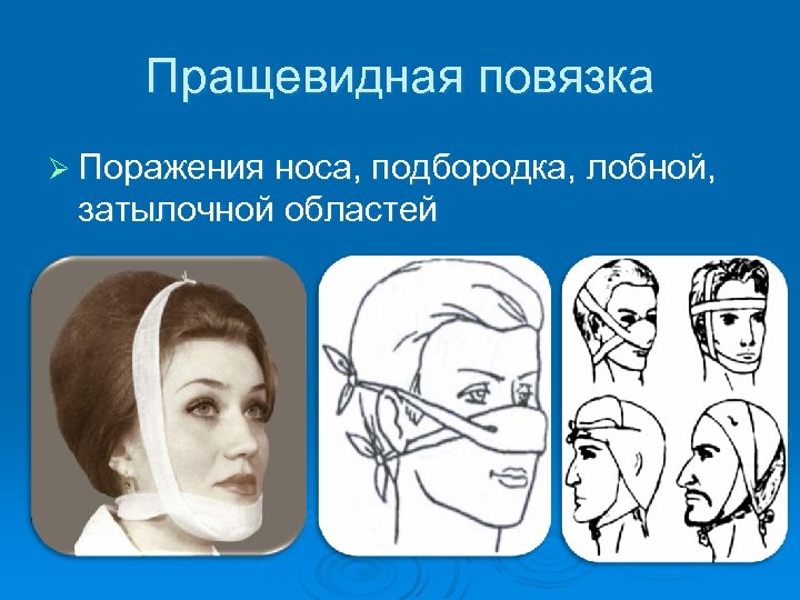 Пращевидная повязка Ø Поражения носа, подбородка, лобной, затылочной областей 