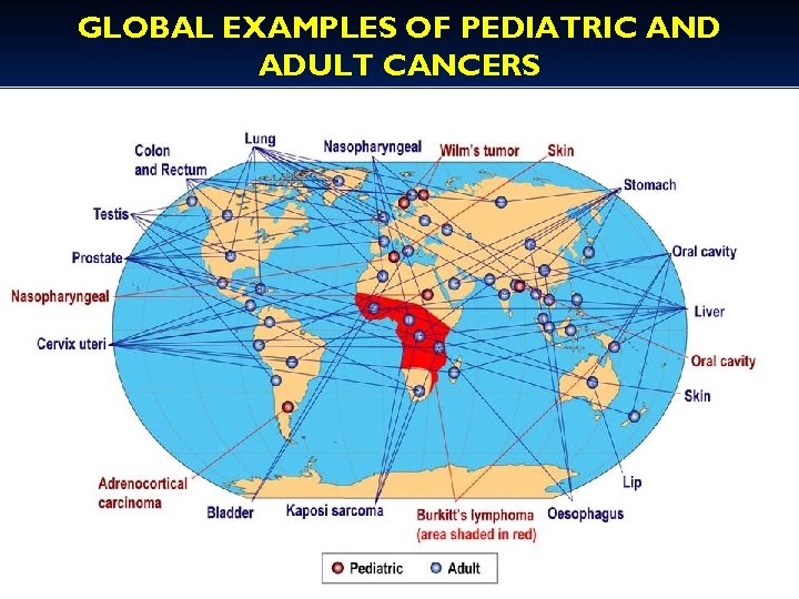 GLOBAL EXAMPLES OF PEDIATRIC AND ADULT CANCERS 