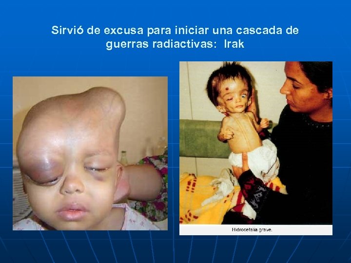 Sirvió de excusa para iniciar una cascada de guerras radiactivas: Irak 