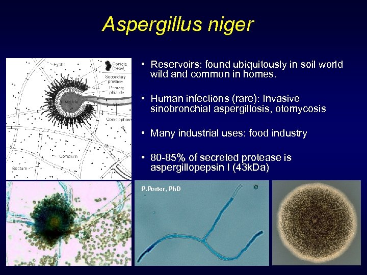 Aspergillus niger • Reservoirs: found ubiquitously in soil world wild and common in homes.