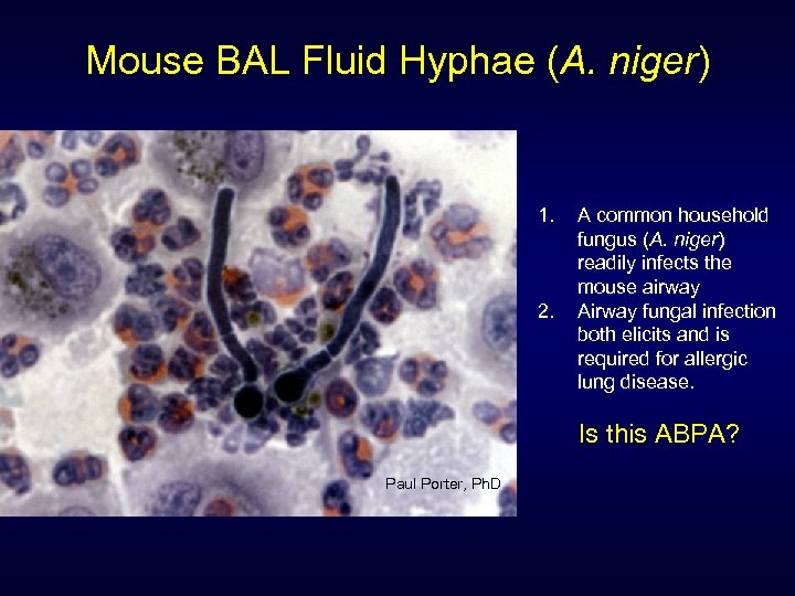 Mouse BAL Fluid Hyphae (A. niger) 1. 2. A common household fungus (A. niger)