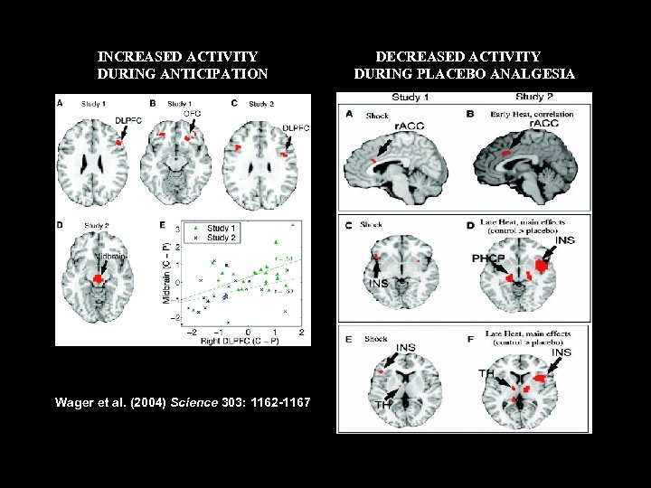 INCREASED ACTIVITY DURING ANTICIPATION Wager et al. (2004) Science 303: 1162 -1167 DECREASED ACTIVITY