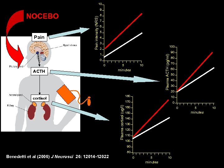 10 NOCEBO Pain intensity (NRS) 9 8 7 6 5 4 3 100 2