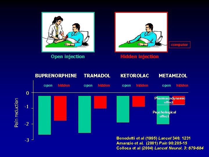 computer Open injection BUPRENORPHINE open hidden Hidden injection TRAMADOL open hidden KETOROLAC open hidden