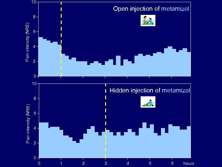 10 Open injection of metamizol Pain intensity (NRS) 8 6 4 2 0 10