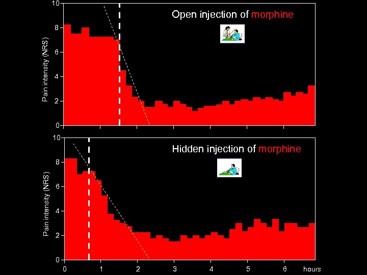 10 Open injection of morphine Pain intensity (NRS) 8 6 4 2 0 10