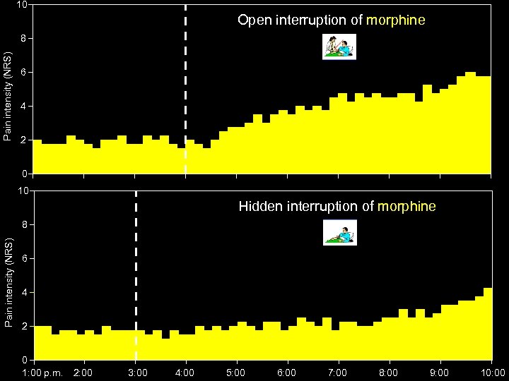 10 Open interruption of morphine Pain intensity (NRS) 8 6 4 2 0 10