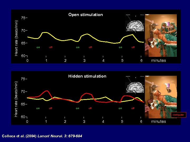 Open stimulation Heart rate (beats/min) 75 70 65 on on off 60 0 1