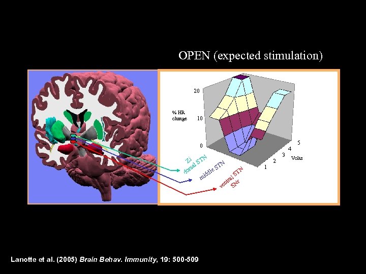 OPEN (expected stimulation) 20 % HR change 10 0 Zi STN l TN rsa