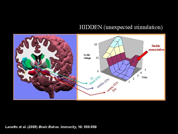 HIDDEN (unexpected stimulation) 20 % HR change limbic associative 10 0 Zi STN l