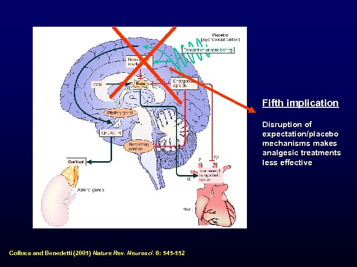 Fifth implication Disruption of expectation/placebo mechanisms makes analgesic treatments less effective Colloca and Benedetti