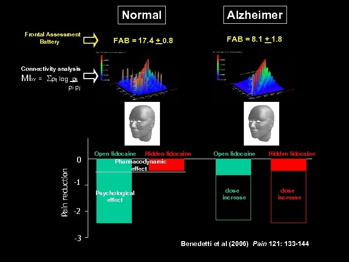 Normal Frontal Assessment Battery Alzheimer FAB = 17. 4 + 0. 8 FAB =