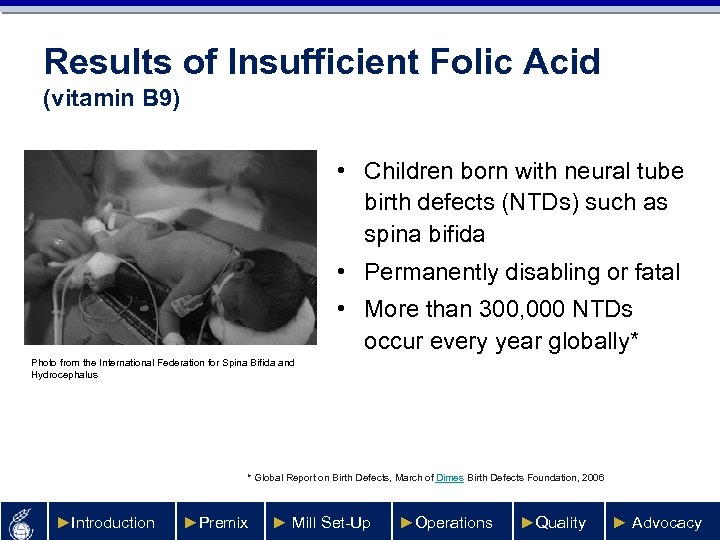 Results of Insufficient Folic Acid (vitamin B 9) • Children born with neural tube