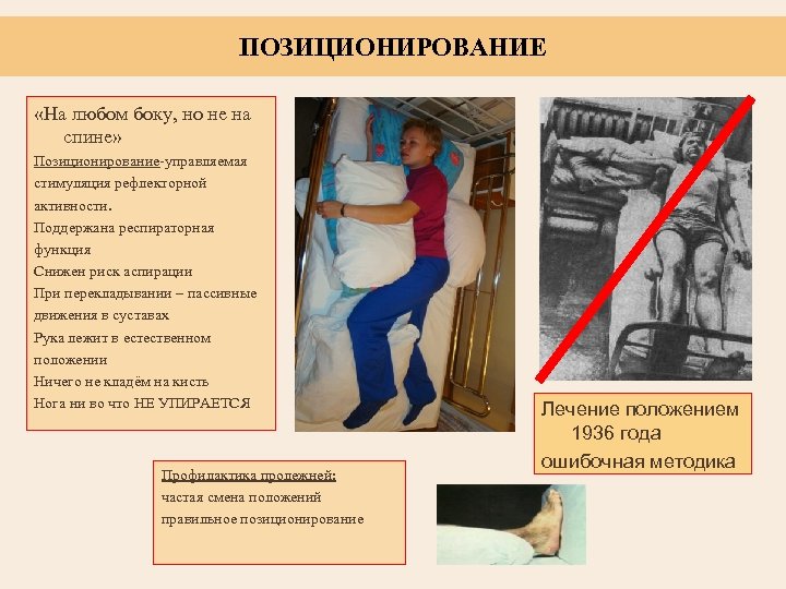 ПОЗИЦИОНИРОВАНИЕ «На любом боку, но не на спине» Позиционирование-управляемая стимуляция рефлекторной активности. Поддержана респираторная