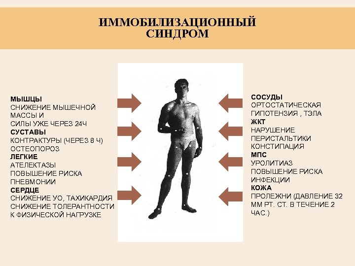 ИММОБИЛИЗАЦИОННЫЙ СИНДРОМ МЫШЦЫ СНИЖЕНИЕ МЫШЕЧНОЙ МАССЫ И СИЛЫ УЖЕ ЧЕРЕЗ 24 Ч СУСТАВЫ КОНТРАКТУРЫ