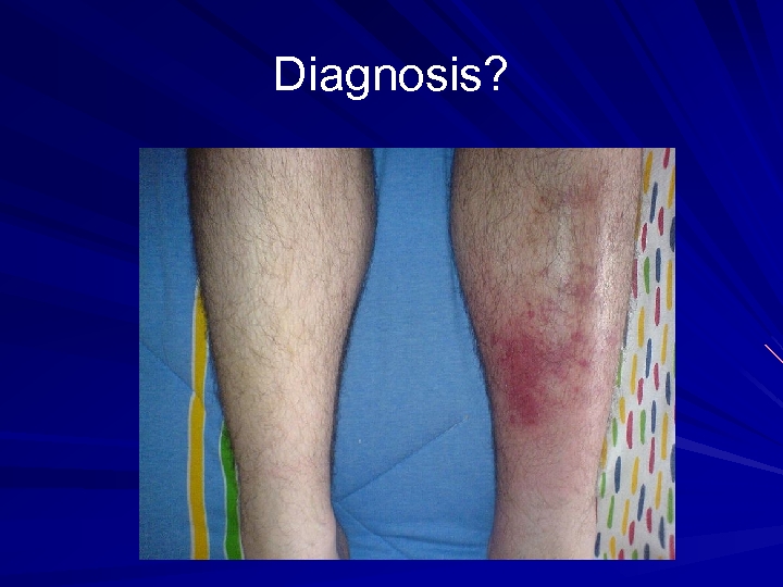 Diagnosis? 