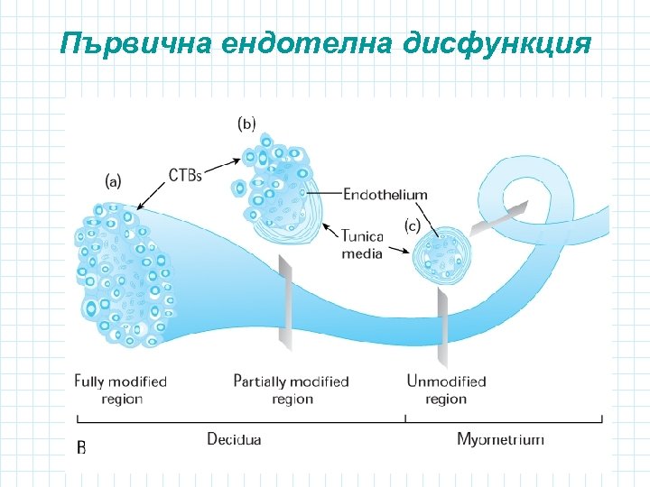 Първична ендотелна дисфункция 