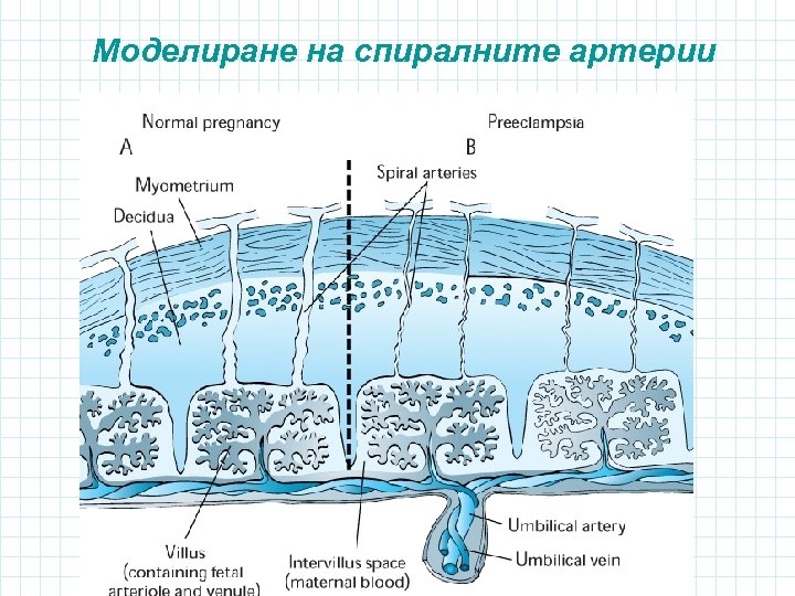 Моделиране на спиралните артерии 
