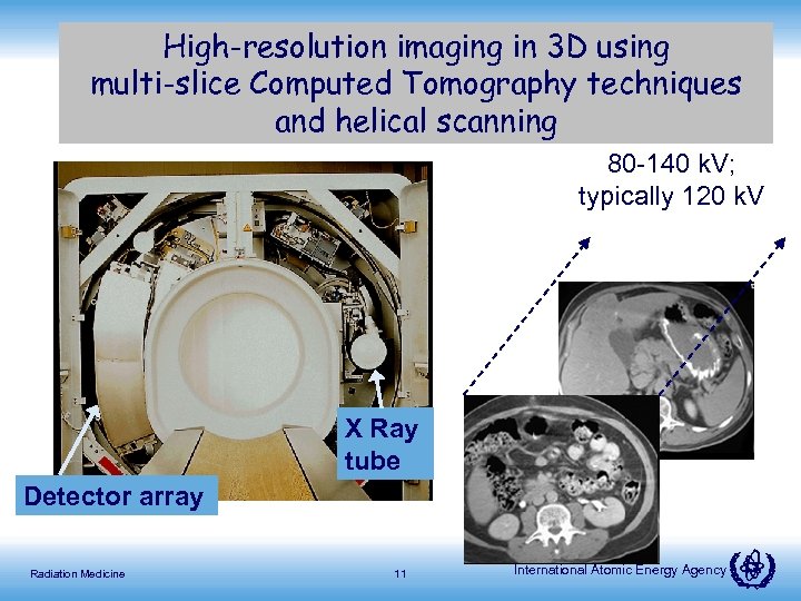High-resolution imaging in 3 D using multi-slice Computed Tomography techniques and helical scanning 80