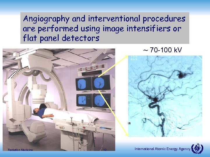 Angiography and interventional procedures are performed using image intensifiers or flat panel detectors ~