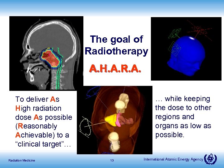 The goal of Radiotherapy A. H. A. R. A. … while keeping the dose