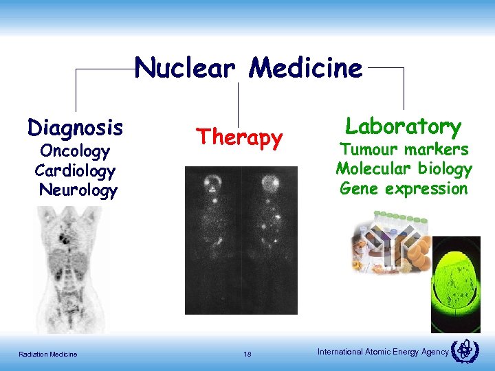 Nuclear Medicine Diagnosis Oncology Cardiology Neurology Radiation Medicine Therapy 18 Laboratory Tumour markers Molecular