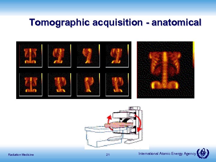 Tomographic acquisition - anatomical Radiation Medicine 21 International Atomic Energy Agency 