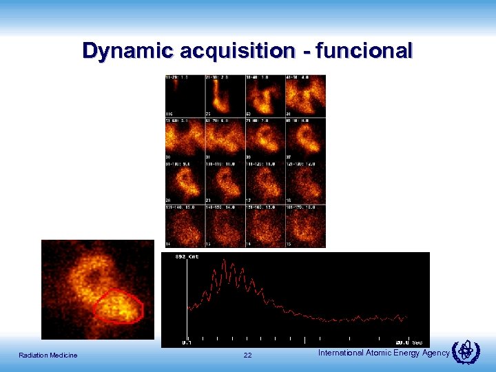 Dynamic acquisition - funcional Radiation Medicine 22 International Atomic Energy Agency 