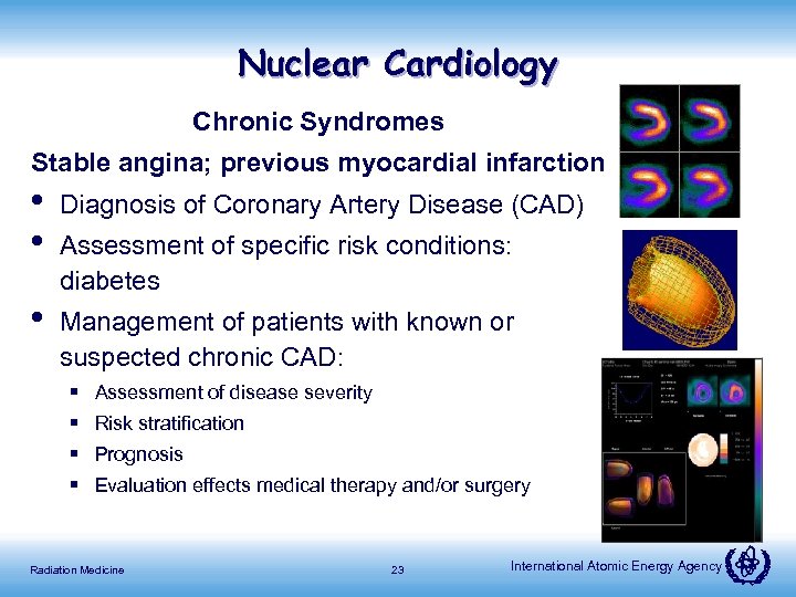 Nuclear Cardiology Chronic Syndromes Stable angina; previous myocardial infarction • • Diagnosis of Coronary