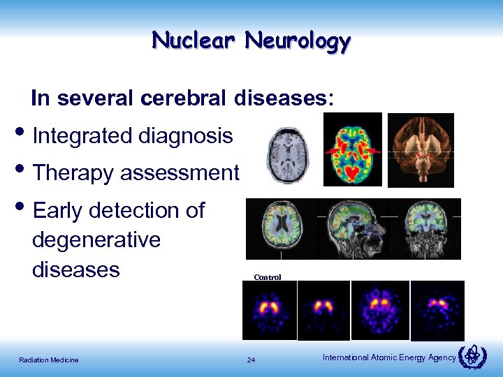 Nuclear Neurology In several cerebral diseases: MRI • Integrated diagnosis • Therapy assessment •