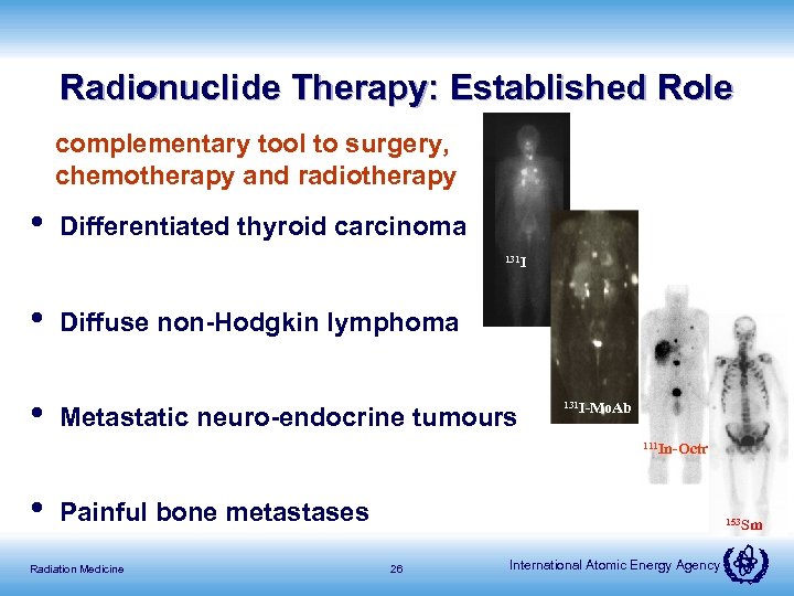 Radionuclide Therapy: Established Role complementary tool to surgery, chemotherapy and radiotherapy • Differentiated thyroid