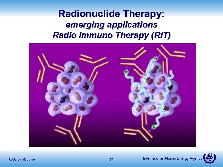Radionuclide Therapy: emerging applications Radio Immuno Therapy (RIT) Radiation Medicine 27 International Atomic Energy