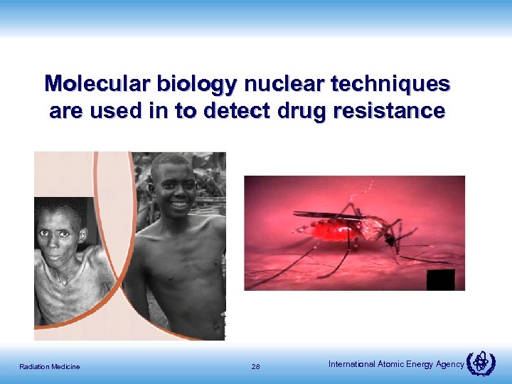 Molecular biology nuclear techniques are used in to detect drug resistance Radiation Medicine 28
