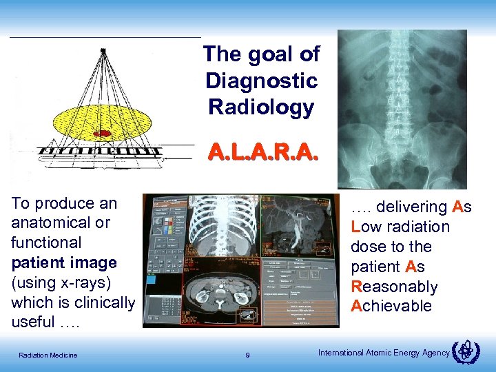 The goal of Diagnostic Radiology A. L. A. R. A. To produce an anatomical